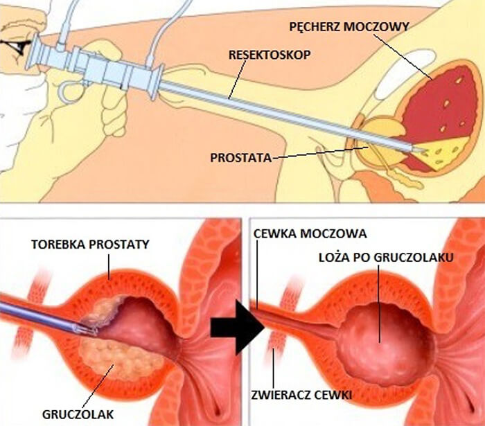 chusteczki pampers 12x64