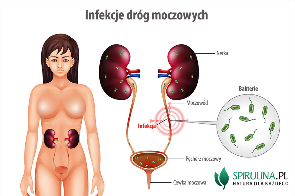 pieluchy dla dorosłych biedronka