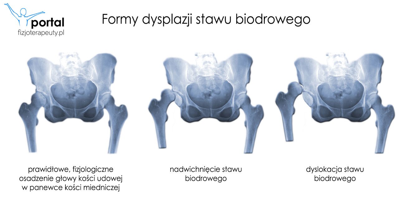 chusteczki nawilżane spłukiwalne